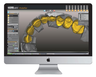 Computer designed zirconia crowns and bridges